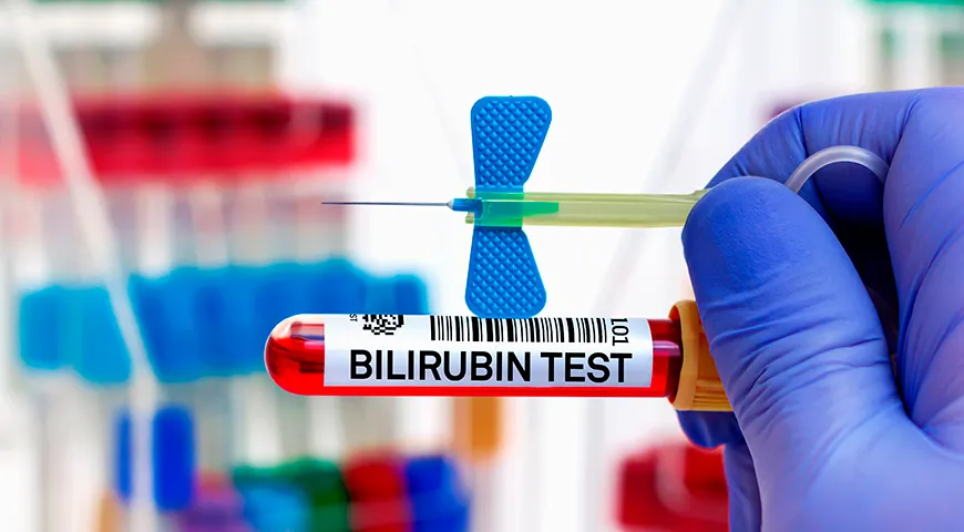 Bilirubin v normě by neměl u dospělého člověka překročit 20,5 µmol/l.